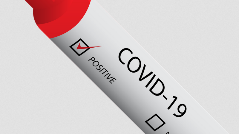 Corona / Covid: Bund übernimmt Kosten für Test +++ „SwissCovid-App“ startet am 25. Juni +++ „Soviel testen wie möglich“